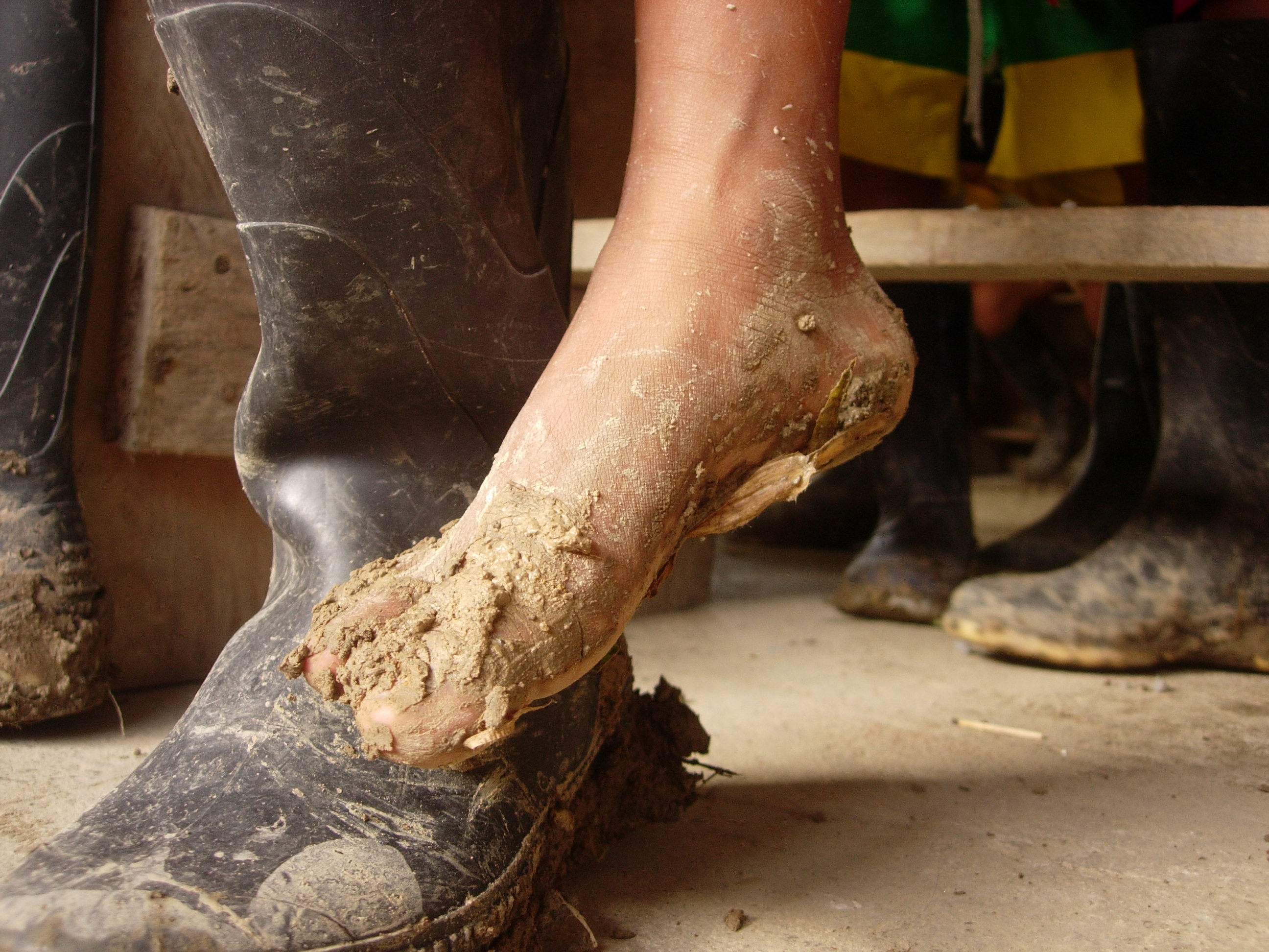 muddy foot